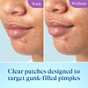 Differin Power Patches for White Head Pimples 23ct