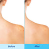 Differin Acne Body Spray- Acne Treatment with Salicylic Acid 170g
