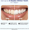 GuruNanda Teeth Whitening Strips Kit - 16-Day Treatment