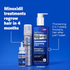 Men's Rogaine 5% Minoxidil Topical Foam, Unscented, 3 x 60g