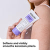 Amlactin KP Bumps Be Gone Body Cream, 15% Lactic Acid 85g