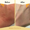 ECZEMA HONEY Oatmeal Body Lotion, Natural Dry Skin Repair 453g