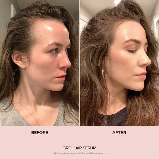 Vegamour GRO Hair Serum for Thinning Hair 30ML